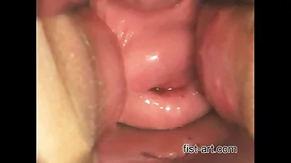 1151 fisting porn videos